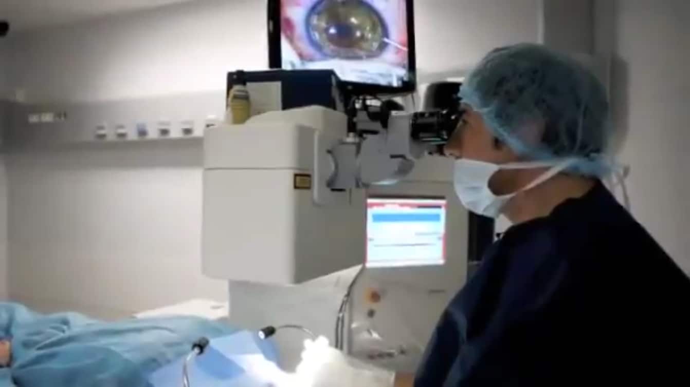 Opération presbytie laser implant
